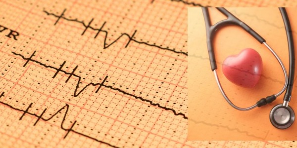 Papeles de Registro para Monitores de ECG: Esenciales para la Precisión en la Cardiología